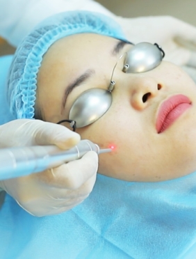 Đốt nốt ruồi, mụn thịt